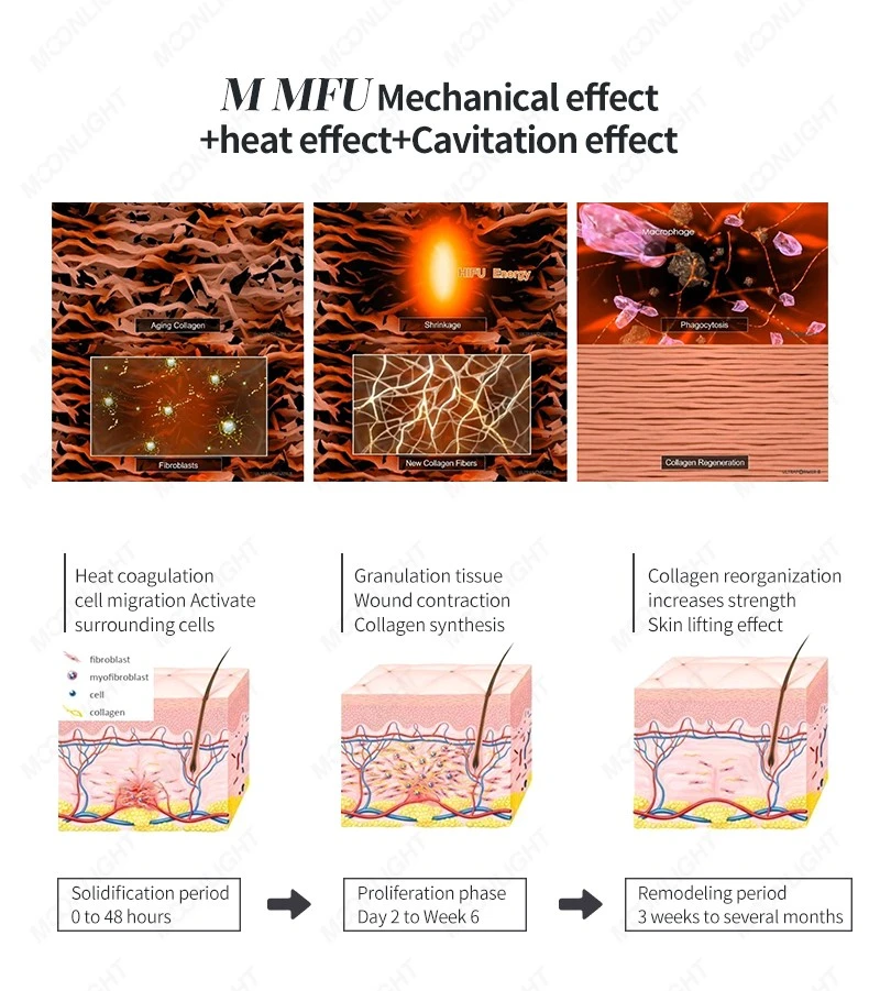 7D Hifu Machine: Revolutionary Non-Surgical Beauty Treatment