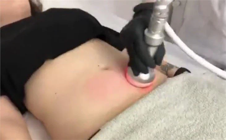 Portable Cryoskin 4.0