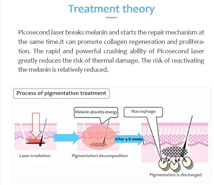 Best Picosecond Laser Machine
