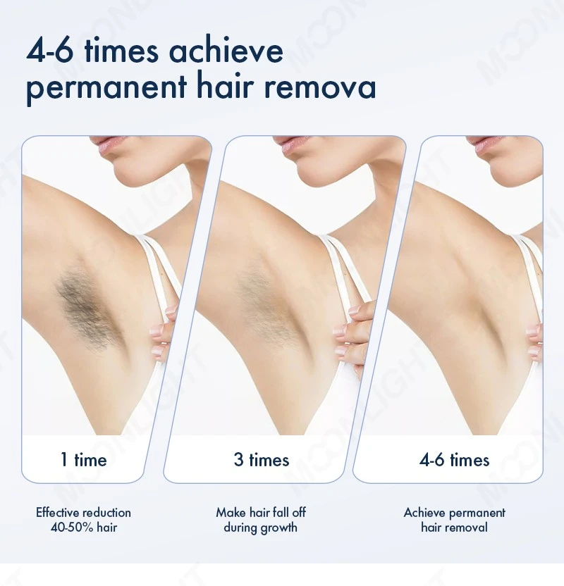 Multifunctional Laser Hair Removal Machine