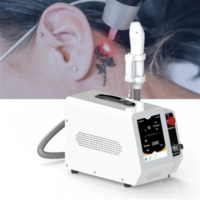 Macchina per la rimozione dei tatuaggi Nd Yag